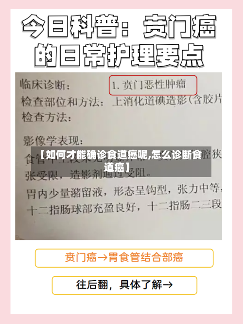 【如何才能确诊食道癌呢,怎么诊断食道癌】-第2张图片