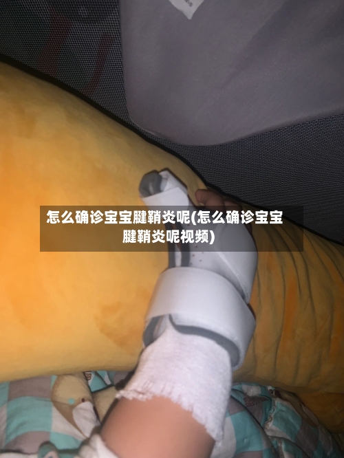怎么确诊宝宝腱鞘炎呢(怎么确诊宝宝腱鞘炎呢视频)