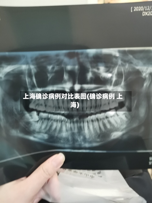 上海确诊病例对比表图(确诊病例 上海)