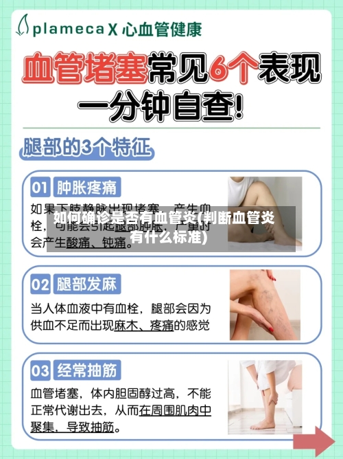 如何确诊是否有血管炎(判断血管炎有什么标准)-第2张图片