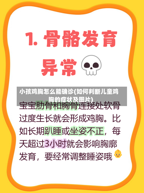 小孩鸡胸怎么能确诊(如何判断儿童鸡胸的症状及图片)