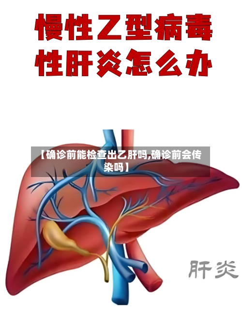 【确诊前能检查出乙肝吗,确诊前会传染吗】-第3张图片