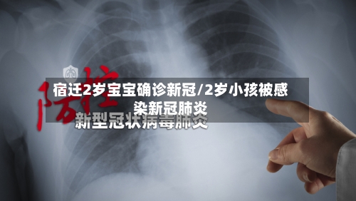 宿迁2岁宝宝确诊新冠/2岁小孩被感染新冠肺炎