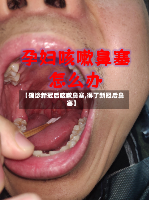 【确诊新冠后咳嗽鼻塞,得了新冠后鼻塞】