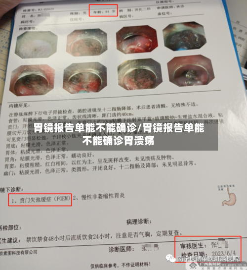 胃镜报告单能不能确诊/胃镜报告单能不能确诊胃溃疡-第2张图片