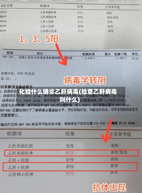 化验什么确诊乙肝病毒(检查乙肝病毒叫什么)-第2张图片