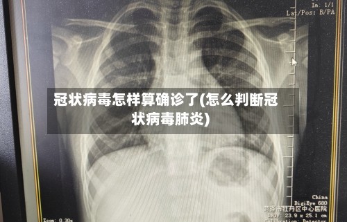 冠状病毒怎样算确诊了(怎么判断冠状病毒肺炎)