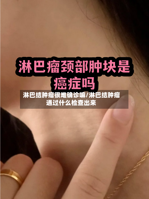 淋巴结肿瘤很难确诊嘛/淋巴结肿瘤通过什么检查出来-第3张图片