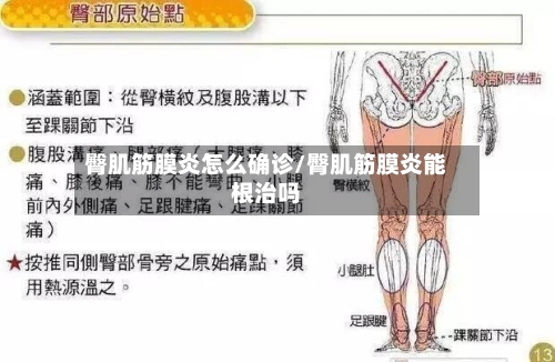 臀肌筋膜炎怎么确诊/臀肌筋膜炎能根治吗