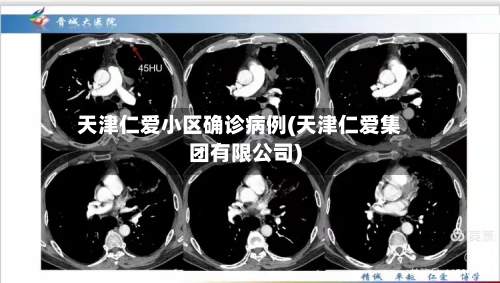 天津仁爱小区确诊病例(天津仁爱集团有限公司)-第3张图片