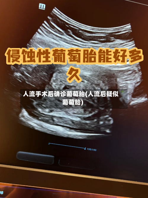 人流手术后确诊葡萄胎(人流后疑似葡萄胎)