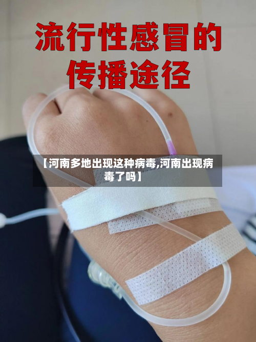 【河南多地出现这种病毒,河南出现病毒了吗】-第2张图片