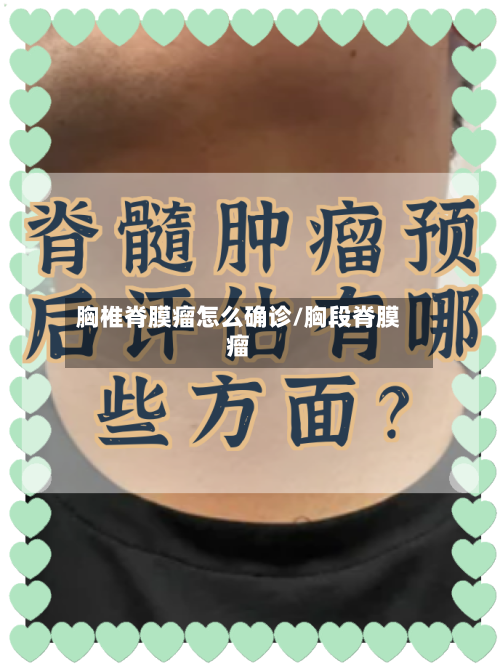 胸椎脊膜瘤怎么确诊/胸段脊膜瘤