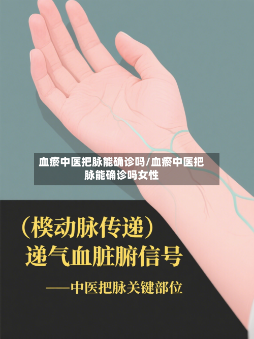 血瘀中医把脉能确诊吗/血瘀中医把脉能确诊吗女性