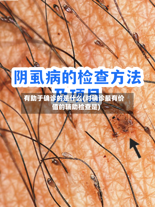 有助于确诊的是什么(对确诊最有价值的辅助检查是)