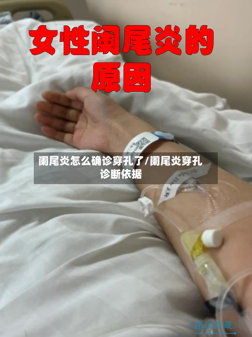 阑尾炎怎么确诊穿孔了/阑尾炎穿孔诊断依据